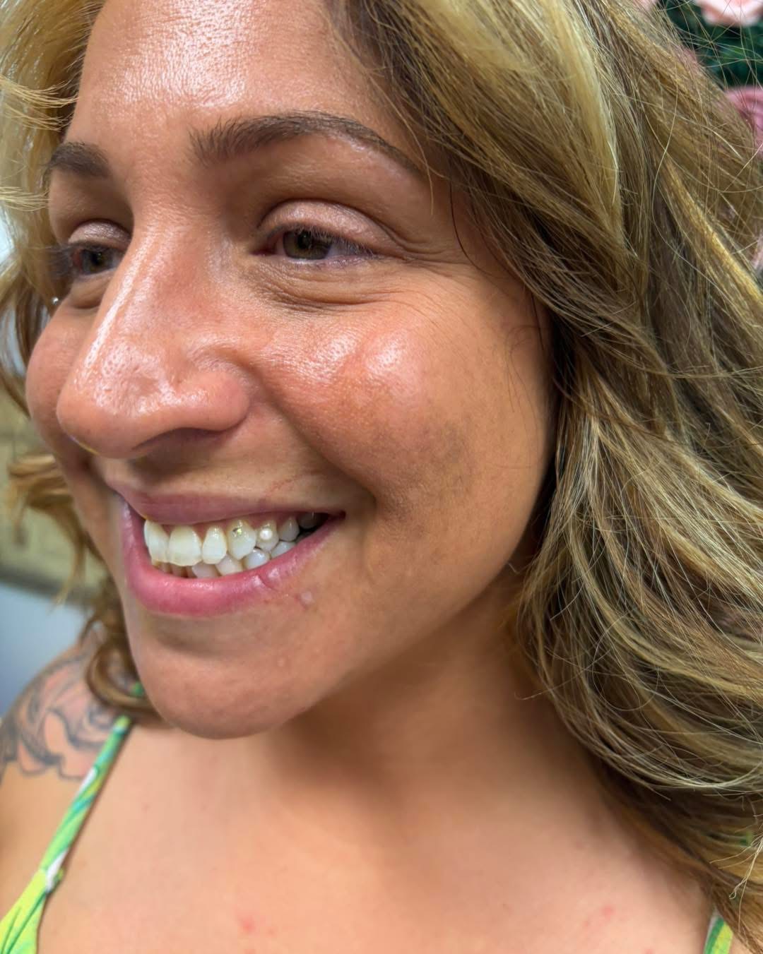 Client smiling with a fresh tooth gem