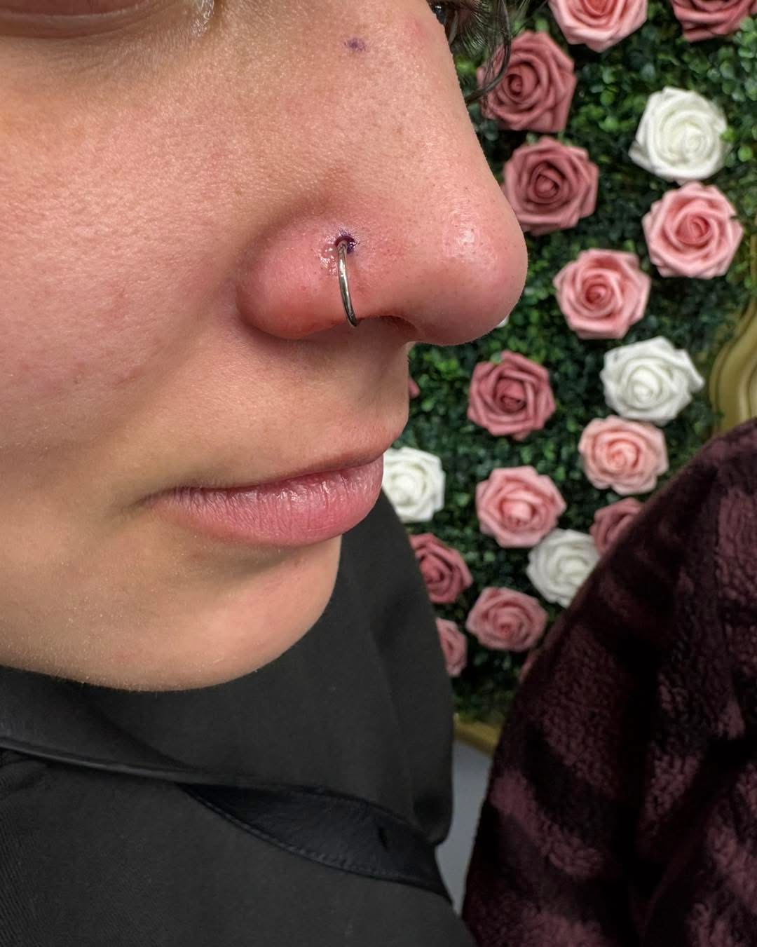 Fresh nostril piercing with a silver hoop